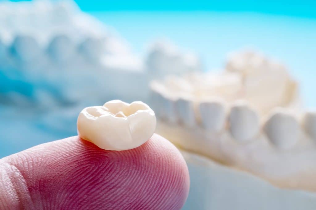 What Type Of Dental Crowns Are Available For Children?